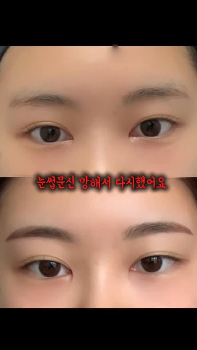 h.young_life 게시물 이미지: 여러분 저 눈썹문신 망하고 다시 했어요 🥹

사실 제가 몇년 전 너무 하고 싶어서...