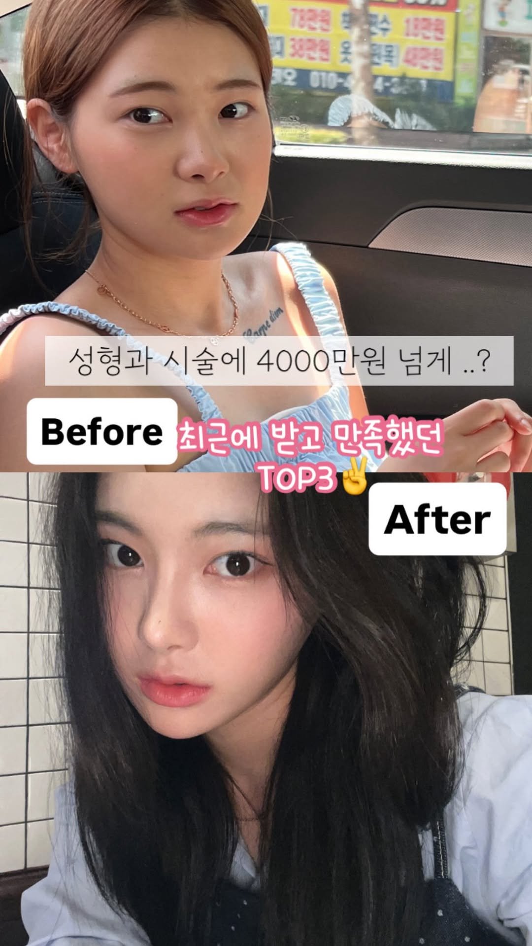 h.young_life 게시물 이미지: #광고 얼굴에 4,000만원 쓴 내가 진짜 최근에 받고
“이건 인정한다” 했던...