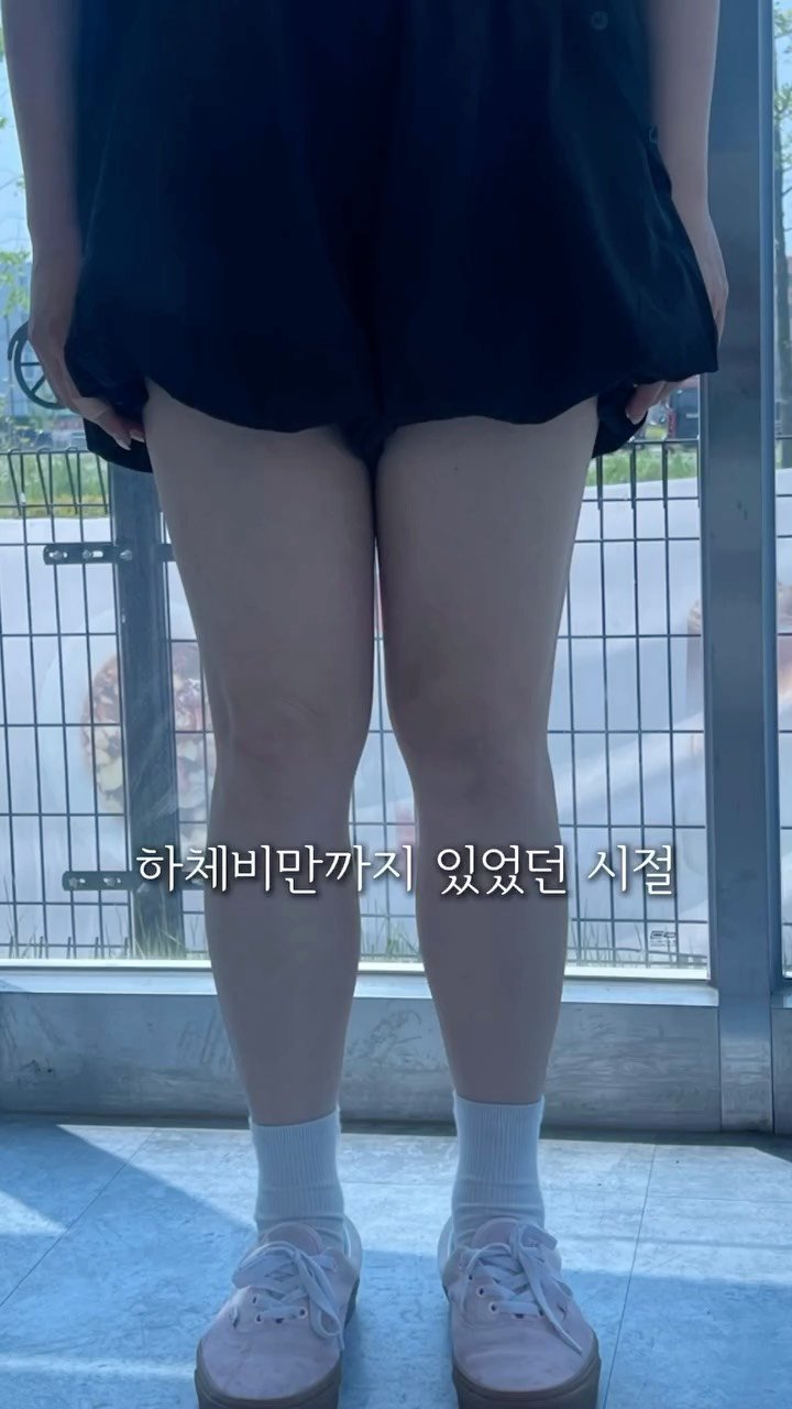 h.young_life 게시물 이미지: (마감) 그래요 저 시집 못가요
성형 + 시술 + 다이어트 모든걸 다 풀고 있어요...