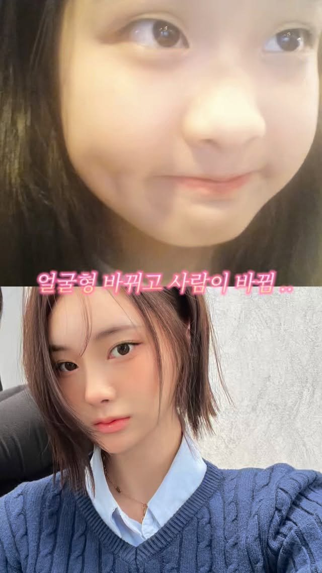 h.young_life 게시물 이미지: @ 친구에게 공유 ..!!
(야 니랑 내 얘긴데 ..?)

얼굴형 바뀌고 사람이...