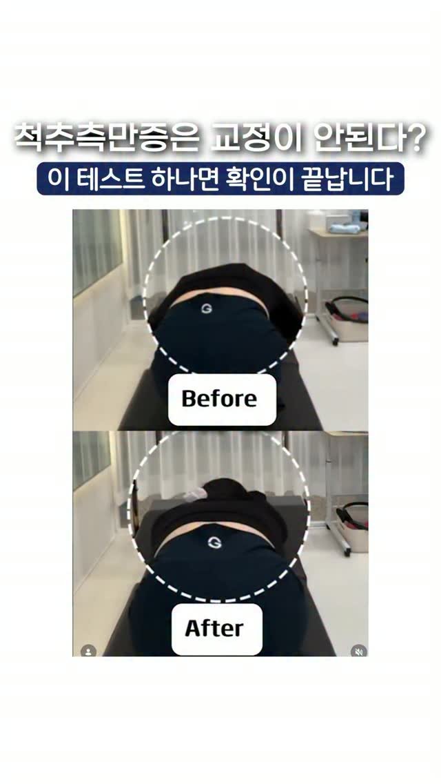 h7_ceo 게시물 이미지: 🚨 “척추측만증은 교정이 안 된다?”

정말 그럴까요?

사실 우리가 목표하는...