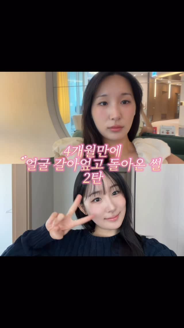 hamzikong 게시물 이미지: 윤곽수술 관련한 정보 궁금하시다면 <윤곽> 남겨주시면 자동 Dm으로 보내드릴께요...