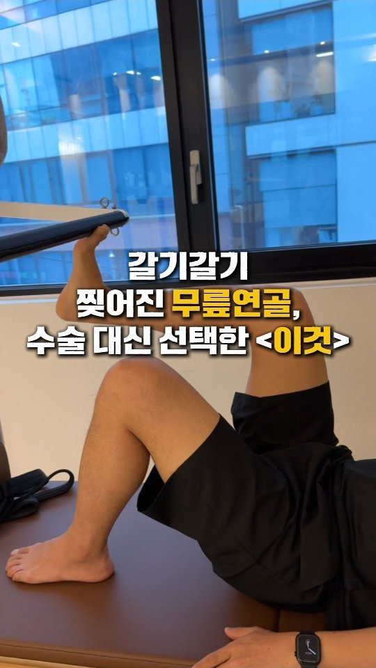 hanna44u_ 게시물 이미지: 🤔 30대에 무릎 연골 파열 진단, "당장 수술해야 합니다"라는 말에 절망하셨던...