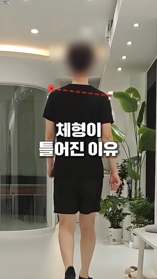 hanna44u_ 게시물 이미지: 🤔 "내 몸이 아픈 게 정말 '체형' 때문일까요?"

"사람들이 자꾸 저보고 다...