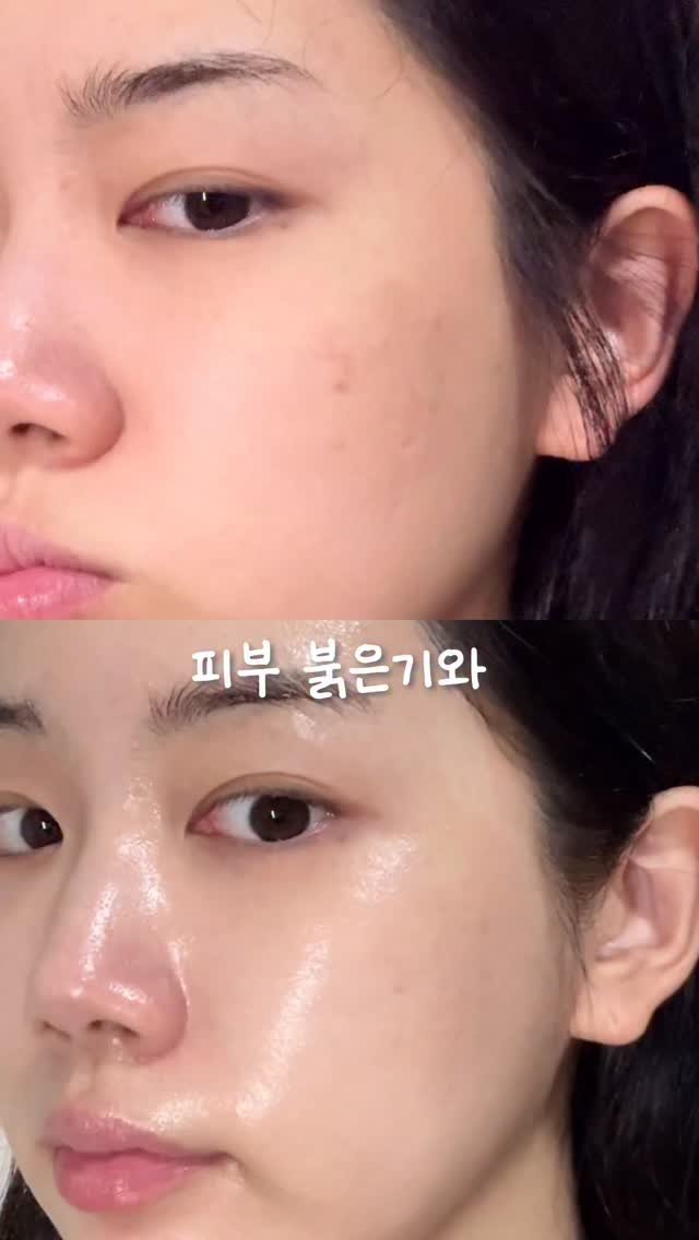happytwenties___ 게시물 이미지: #광고
붉어진* 피부 진정시키는데 이거만한건 없거든요,,

속손상**부터 피부...
