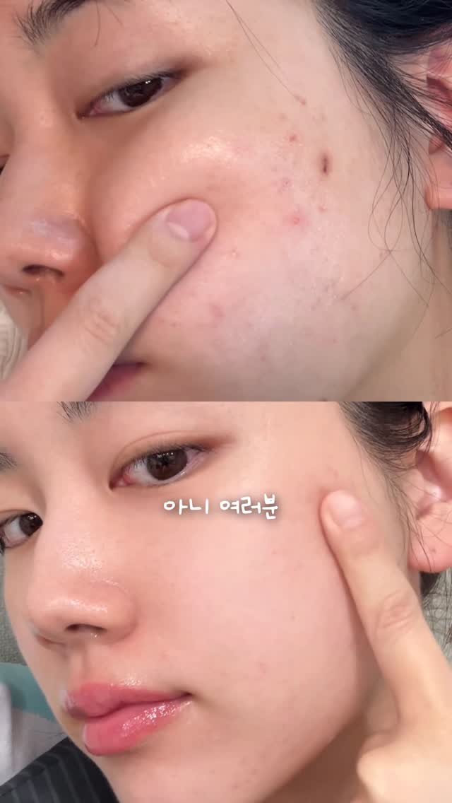 happytwenties___ 게시물 이미지: 원영공주 공병템 손민수 결과는!?
환절기 예민해진 피부를 책임질
글로벌 1등 진정...