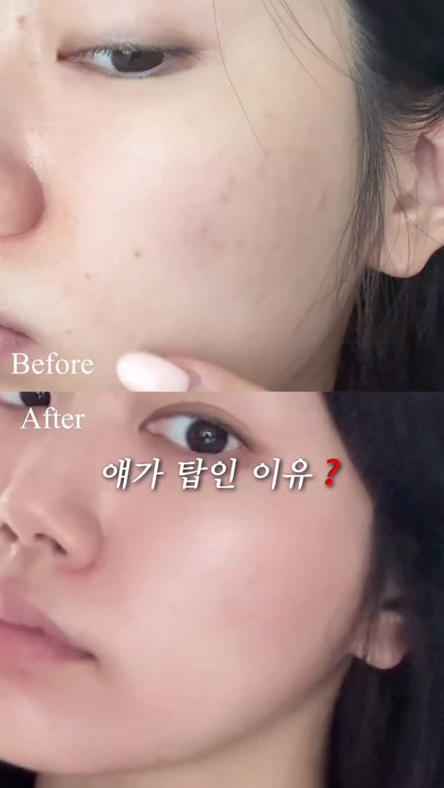 happytwenties___ 게시물 이미지: #광고 #팔로워이벤트

제가 진짜 3개월동안 쓴 애정템, 바이오더마 시카비오...