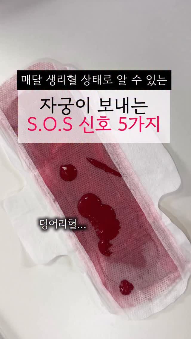 happyyaksa 게시물 이미지: (🔴공유) 방치하지마세요. 자궁의 S.O.S 신호🚨

🩸선홍색 묽은 생리혈
▪️철분...