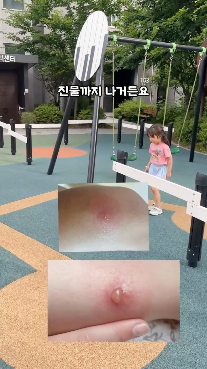 haru__salim 게시물 이미지: 🏷️10번째 공구 중에 첫번째 공구제품은 바로 이거예요!!!

저희 애는 모기 한...