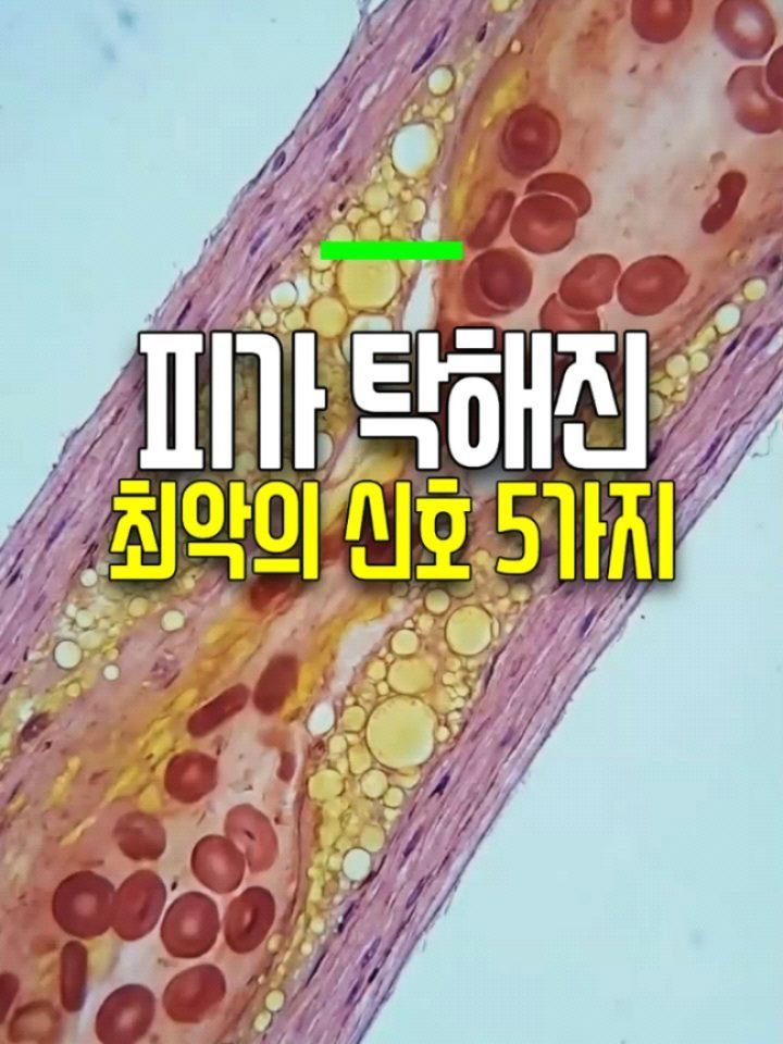health_genius_ 게시물 이미지: 