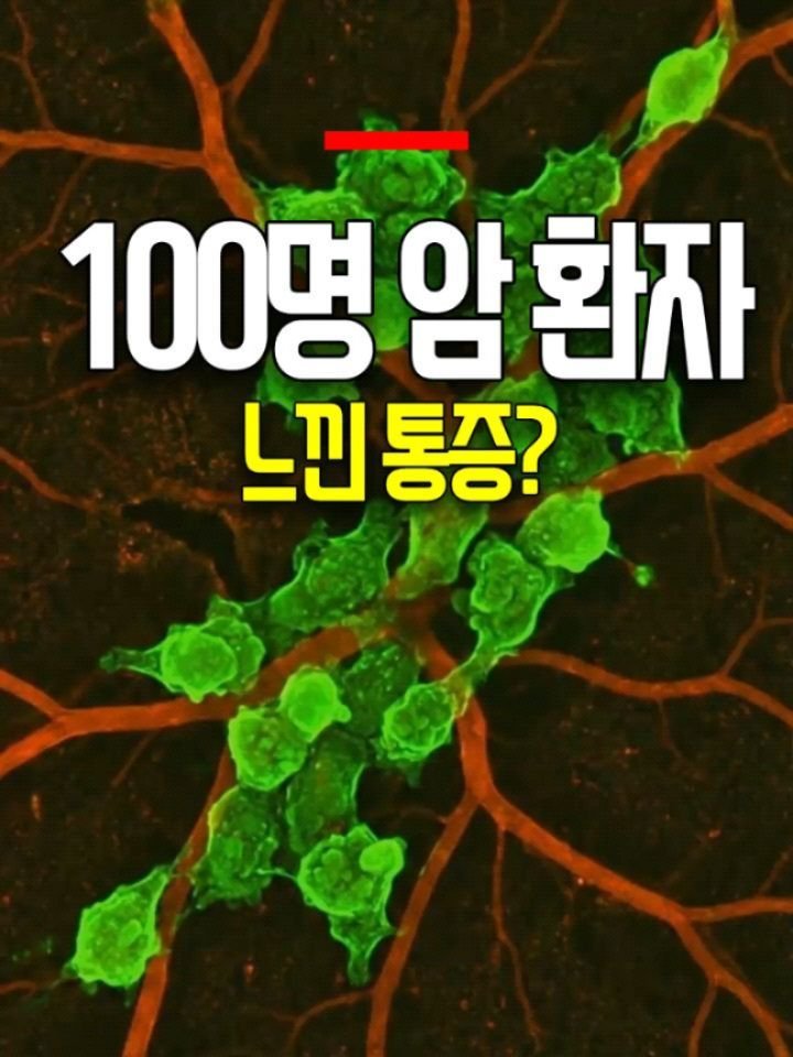 health_genius_ 게시물 이미지: 100명의 암 환자가 느낀 통증?

단순한 근육통인 줄 알았는데 
알고 보니 암의...