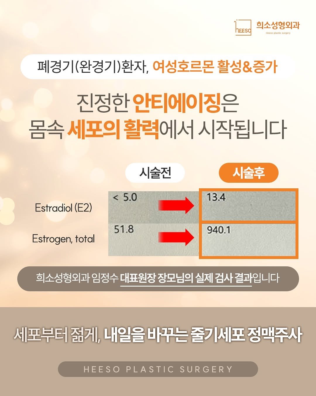 heeso_ps 게시물 이미지: 실제 검사수치로 입증된 줄기세포 효과 공개 📈

가족, 그리고 소중한 사람에게 가장...