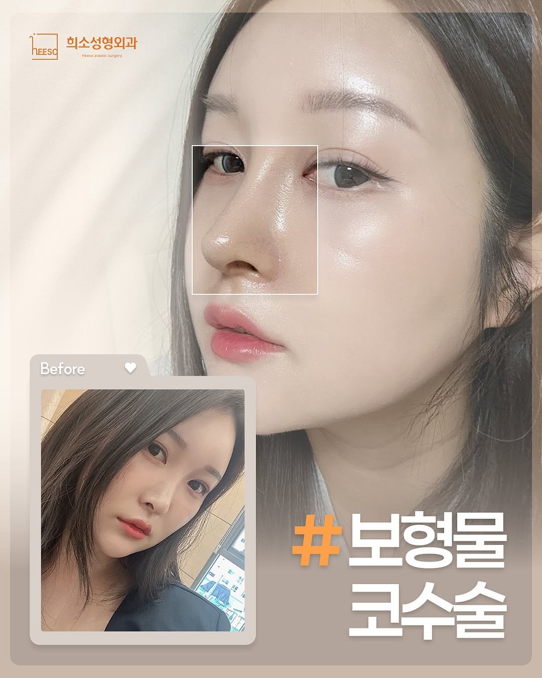 Photo by 희소성형외과 | 대전성형외과 | 임정수 대표원장🥼 in 희소성형외과.