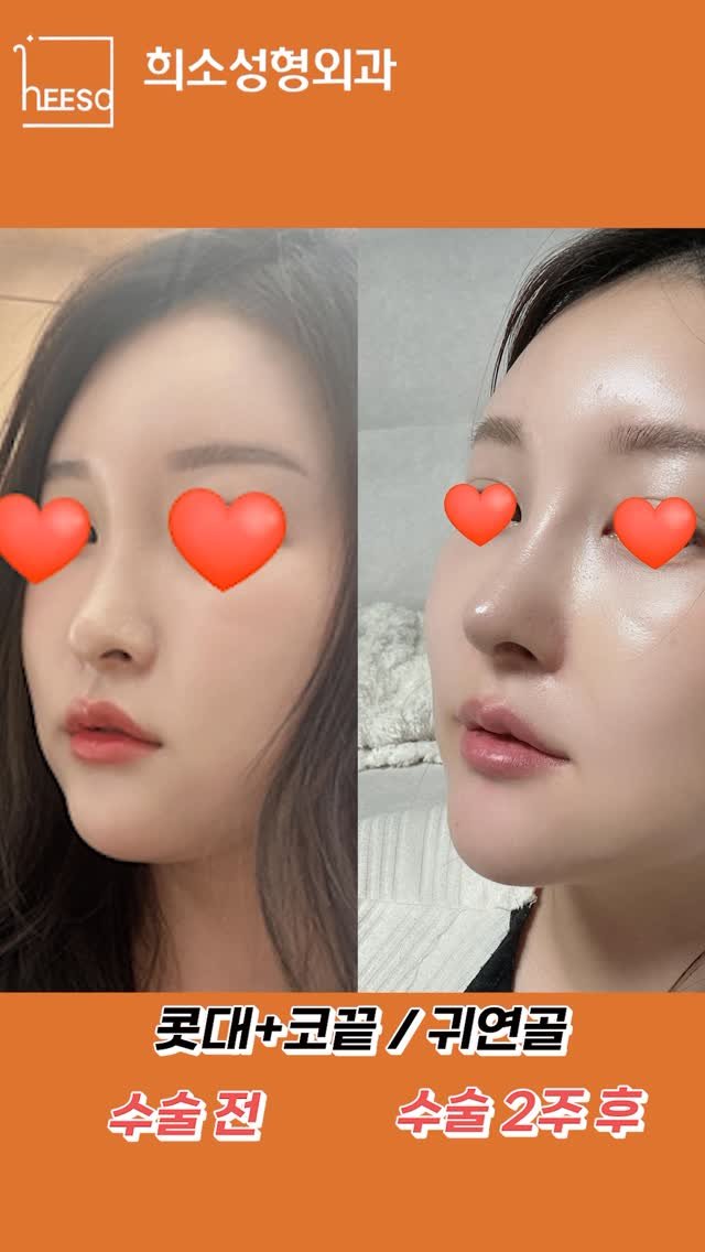 heeso_ps 게시물 이미지: 콧대부터 코끝까지,
한 끗 차이로 완성되는 입체감! ✨

밋밋했던 옆라인이 살아나는...