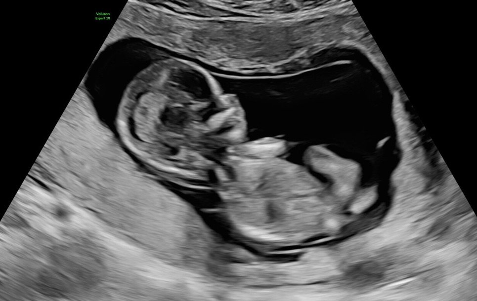 Photo by 희수 영어 on April 17, 2026. May be an image of xray and text.