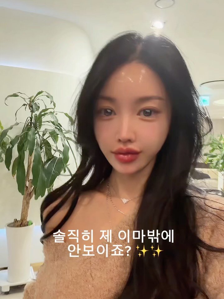 heididrinkslove 게시물 이미지: 100미터 멀리서도!!
제 여기밖에 안보인다구요!!!! 
바로 바로 제 이마!!
저...