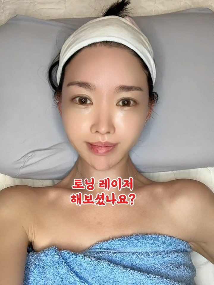 heididrinkslove 게시물 이미지: 토닝레이저 한번쯤 고민했다 손🙋♀️
지긋지긋 기미없애구 & 하얘지고...