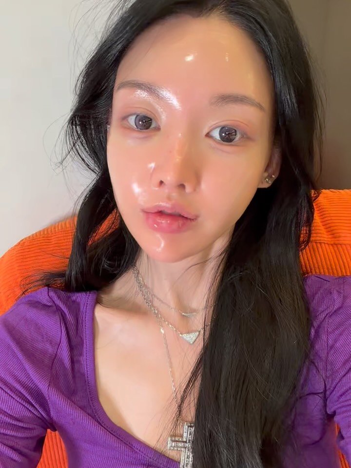 heididrinkslove 게시물 이미지: 달걀팩!! 빼빼로데이 최저가!
자 아픈 보톡스 이제 그만 ✋❌
이제 부작용없는❌...