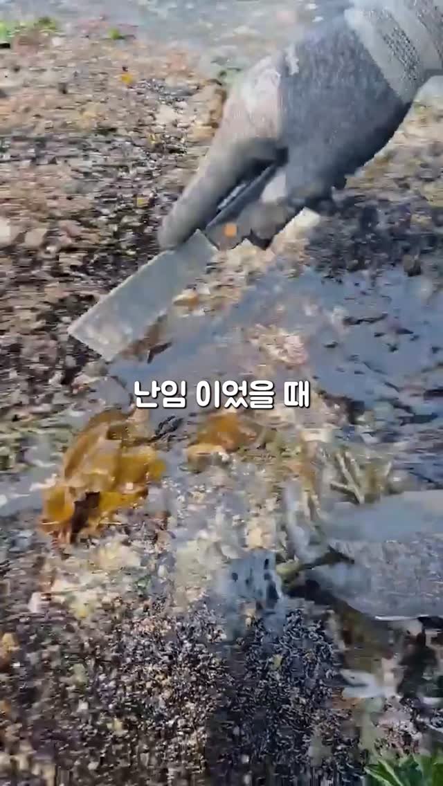 hivus.inc 게시물 이미지: 수술해주신 의사샘은
다난성 호르몬 장애 
과월경 무월경 이슈는 모르고...