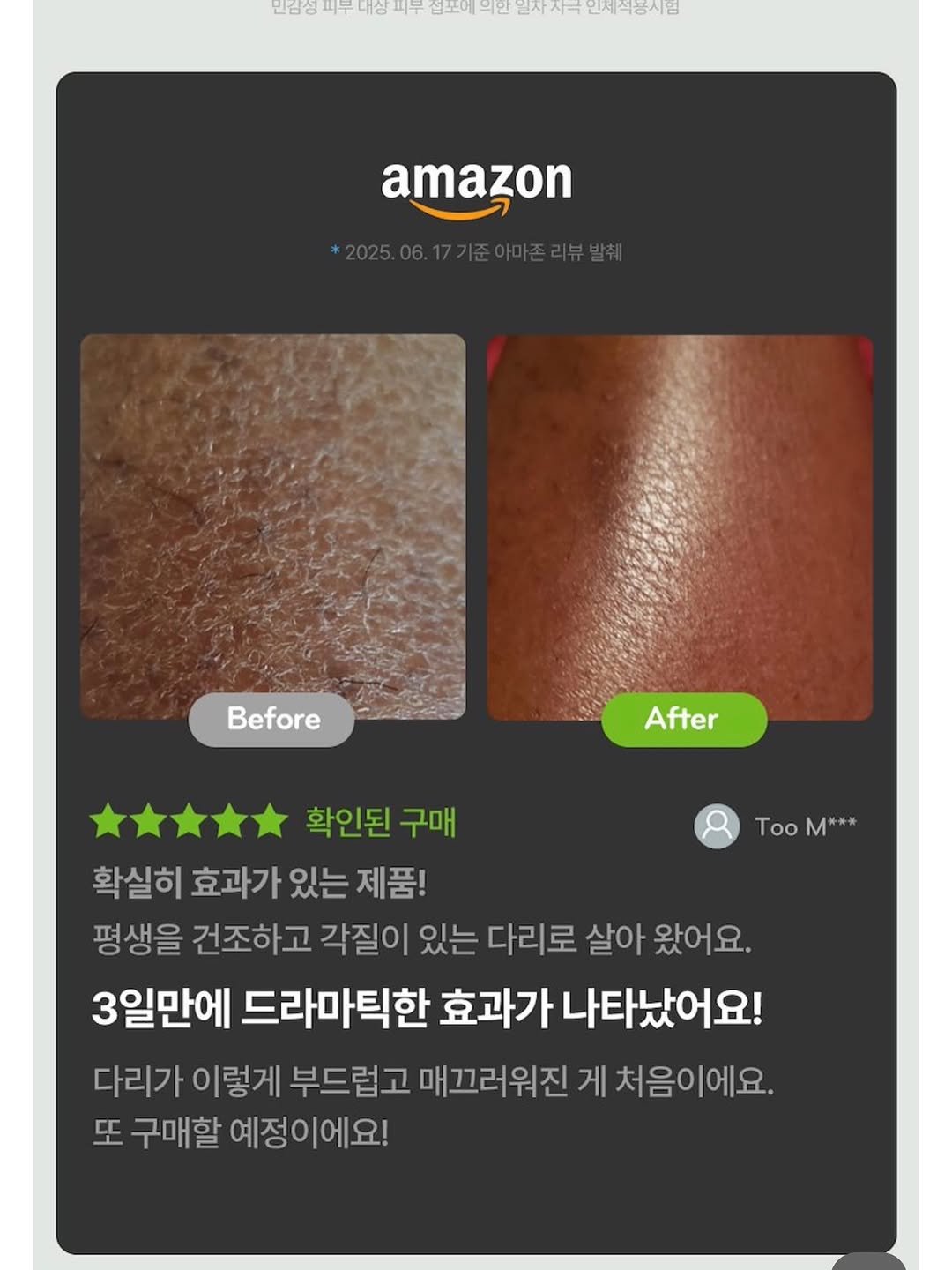 Photo by 허안나 on February 17, 2026. May be an image of ointment, lotion and text that says '민김장 피부 내상 피누 법포에 .만 냉생경자두내장민부심요에부민받(자금고1%이8 인사사고 인제식봉사험 amazon *2025.06.17기준아미존리뷰반취 *2025.06.17기 Before After TooM*** M*** Too 확인된 구매 확실히 효과가 있는 제품! 평생을 건조하고 각질이 있는 다리로 살아 왔어요 3일만에 드라마틱한 효과가 나타났어요! 다리가 이렇게 부드럽고 매끄러워진 게 처음이에요. 또 구매할 예정이에요!'.