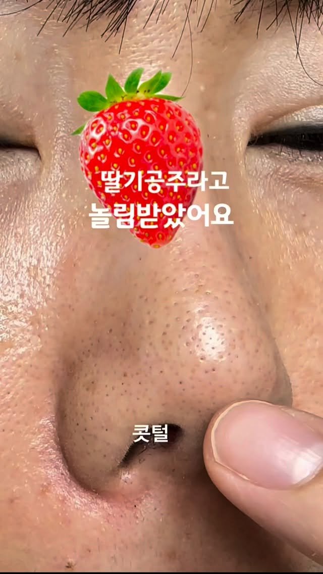 huranna 게시물 이미지: 발렌타인..아니 블랙헤드40년 산… 3번 만에 쏘옥
이거, 그냥 스크럽...