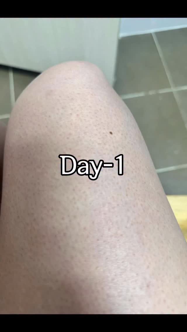 huranna 게시물 이미지: 21일 동안 겪은 변화✌️직접 겪어서 더 자신있게 말할 수 있어요!

문제성 피부로...