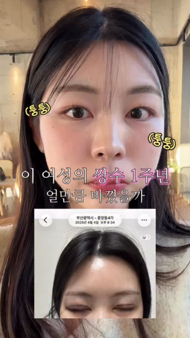 hwangberry_ 게시물 이미지: 쌍수 1주년 전후 뭐가 더 나아요?
답답한 인상에서 제법 화려해진것 같기도하고...