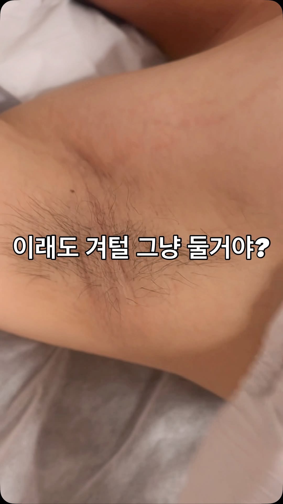 hxx9_6 게시물 이미지: 여친이 제모해달라던 부위 1위 🧼
✔️ 여름엔 흰티 입을 때 가장 많이 보이는...