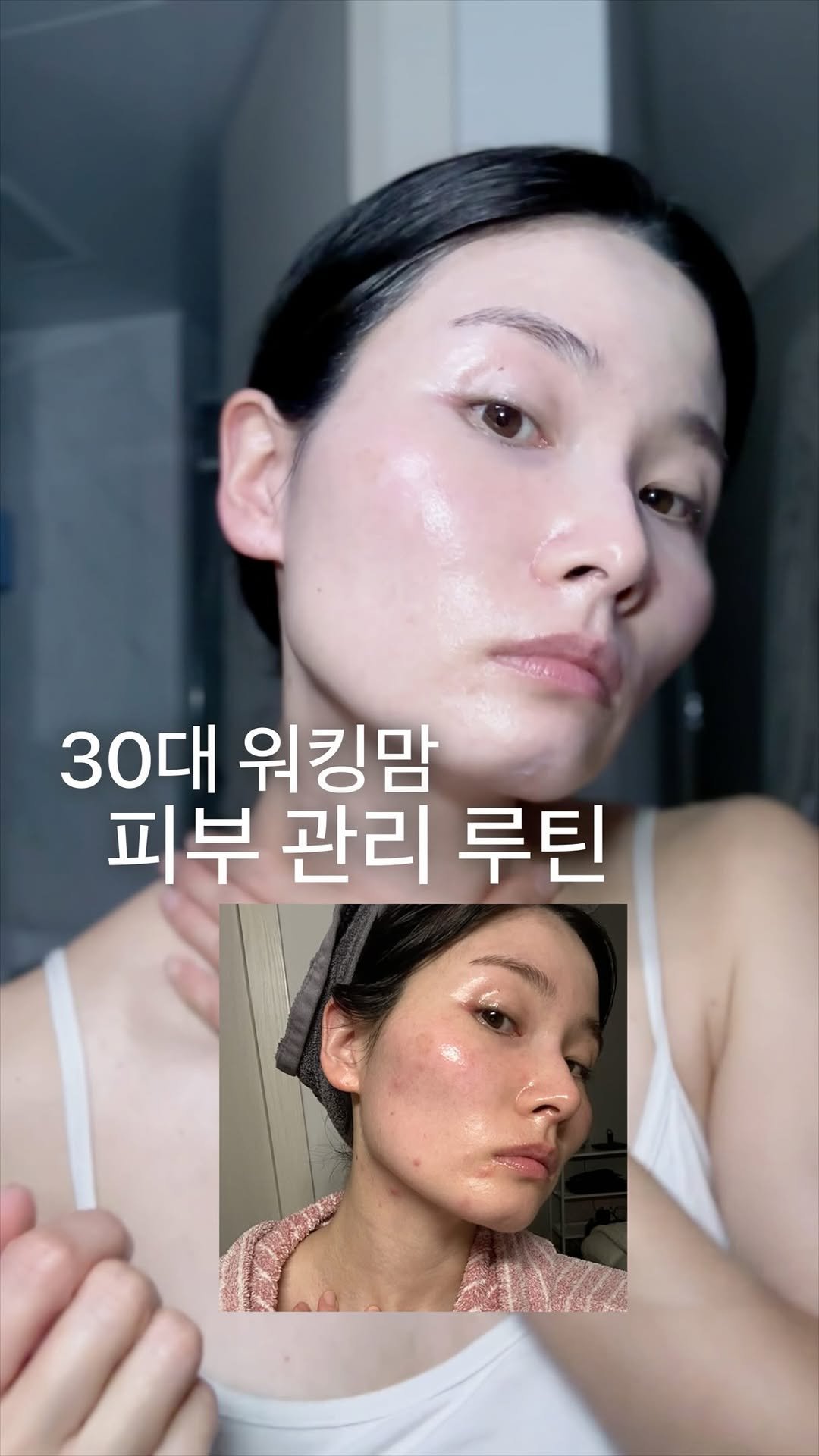 hyeni_fit 게시물 이미지: 기초 케어로 피부과 이길 수 없지만
똑똑하게 사용하면 피부과 없이도 
피부 컨디션...