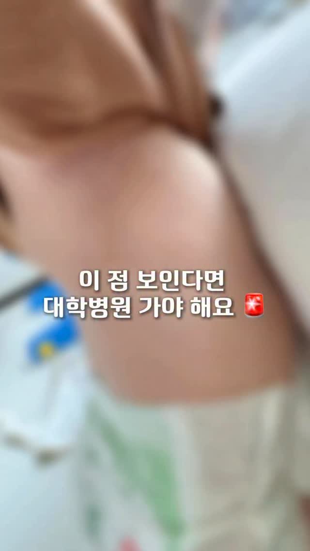 iiinimama_ 게시물 이미지: 이니가 6개월 때 겨드랑이에 작게 생긴 점이
조금씩 커지기 시작했어요.
걱정돼서...