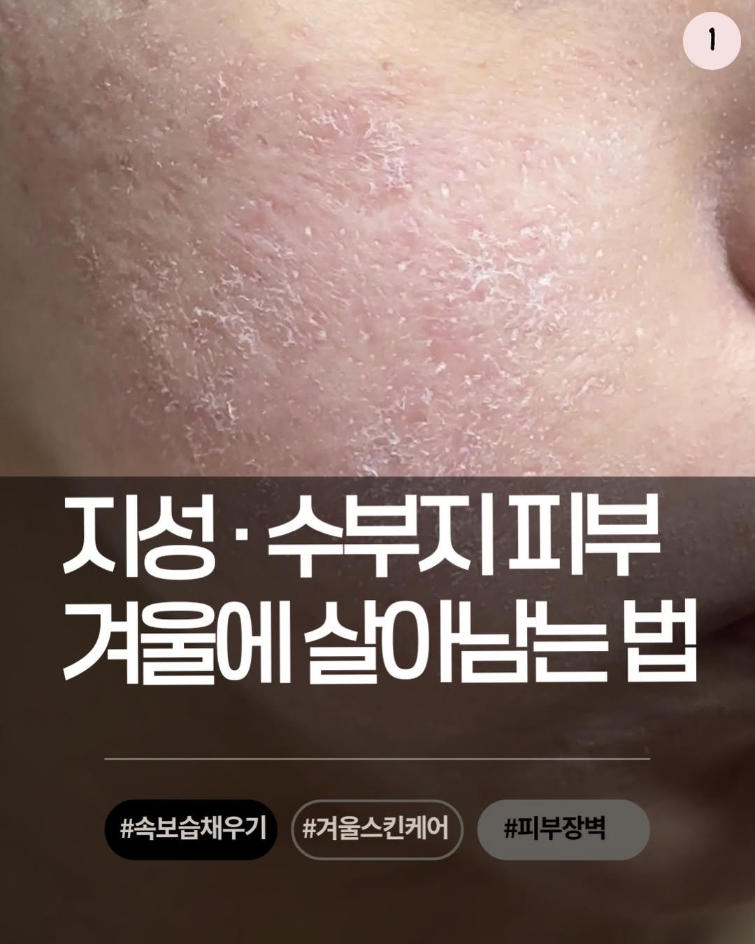 Photo by 뷰드름유튜버 인씨 inssi on December 11, 2025. May be an image of text that says '1 지성· 수부지피부 겨울에 살아남는 살아님는법 법 #속보습채우기 #겨울스킨케어'.