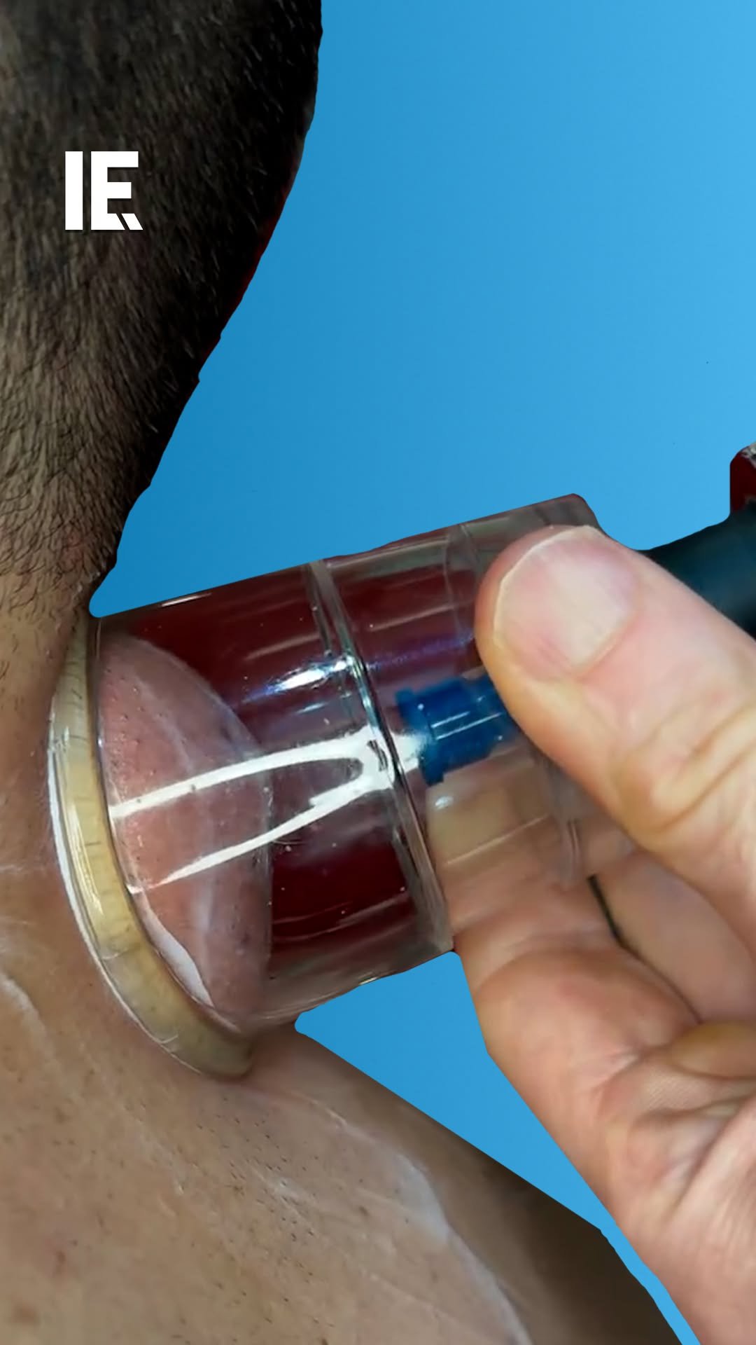 interestingengineering 게시물 이미지: Would you do this for your sore neck? 

📹: @dr_kyleross