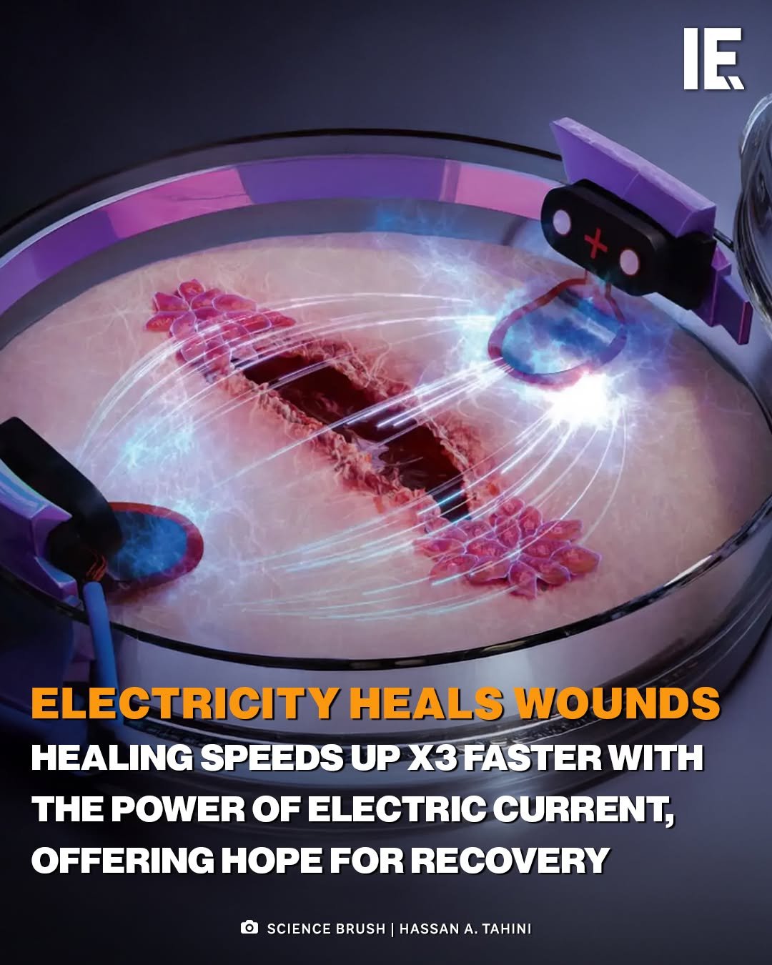 Photo by Interesting Engineering on April 28, 2026. May be an image of poster, socket and text that says 'IE ELECTRICITY HEALS WOUNDS HEALING SPEEDS UP X3 FASTER WITH HE POWER OF ELECTRIC தள CURRENT, OFFERING HOPE FOR RECOVERY SCIENCE BRUSH HASSAN A. N'.