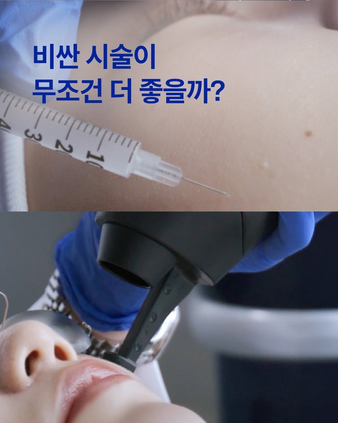 iope_official 게시물 이미지: ⠀⠀⠀⠀⠀⠀⠀⠀
💡시술 비용이 비싸다고,
효과가 무조건 더 좋고...