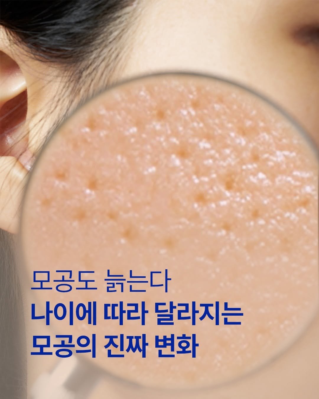 iope_official 게시물 이미지: ⠀⠀⠀⠀⠀⠀⠀⠀
💡모공이 늙으면 어떻게 변할까요?

모공은 단순 피부의 구멍이...