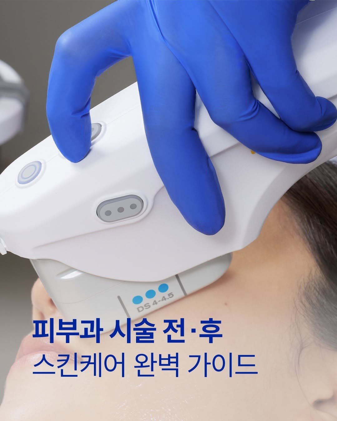 iope_official 게시물 이미지: ⠀⠀⠀⠀⠀⠀⠀⠀
💡피부과 시술 전·후, 피부관리 핵심 가이드

시술 전에는 자외선...