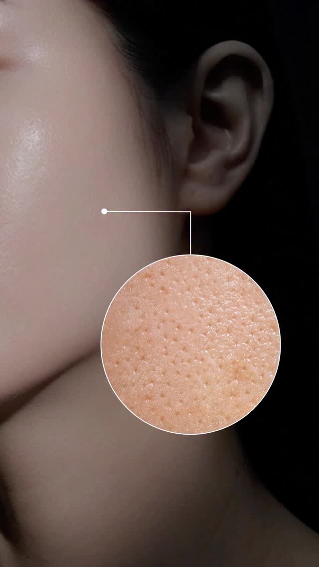 iope_official 게시물 이미지: ⠀⠀⠀⠀⠀⠀⠀⠀
피부 탄력 저하의 첫 시그널인 모공,
늘어져 서로 연결되어 “모공...