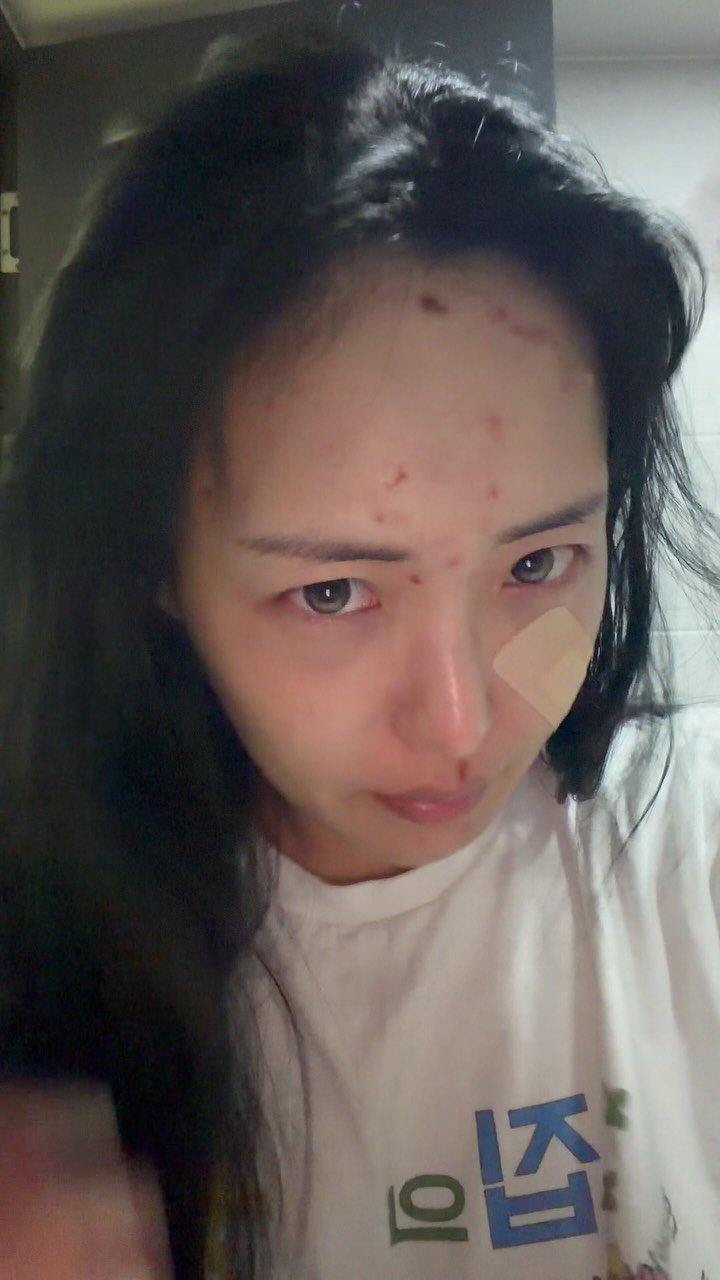 itshaseo 게시물 이미지: 피부의 중요성🥹

솔직히 피부 좋다는 소리 듣는 지금도
불과 한 달 전 영상만 보면...