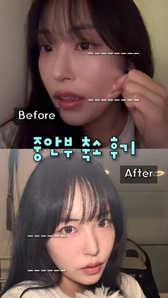 itshaseo 게시물 이미지: 중안부 정병 걸린 공주님들 계신가요…?🙌🏻

사진 찍어도 뭔가 계속 얼굴이...