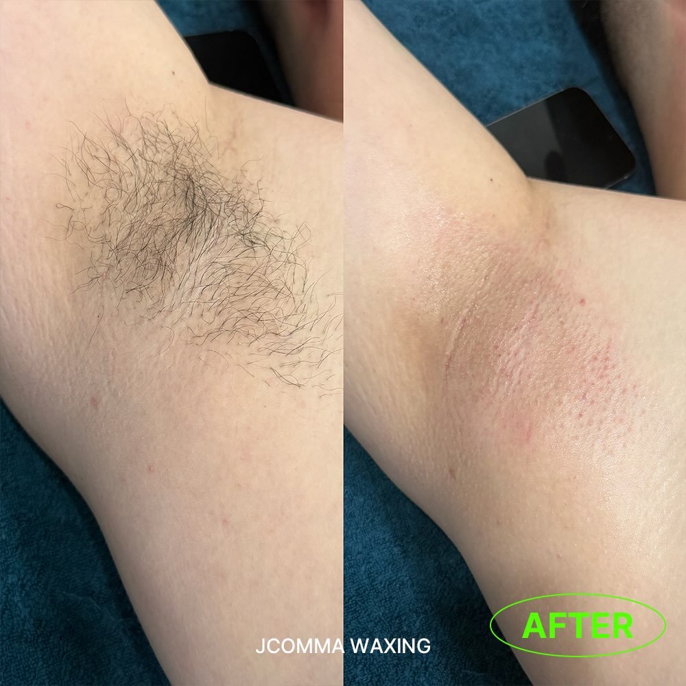 Photo by 제이콤마 대표원장 김주승 🇰🇷 on March 28, 2026. May be an image of text that says 'JCOMMAWAXING JCOMMA WAXING AFTER'.