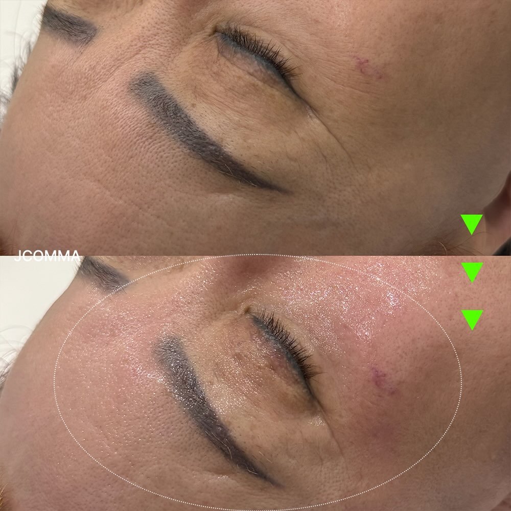 Photo by 제이콤마 대표원장 김주승 🇰🇷 on March 10, 2026. May be an image of text that says 'ICOMMA'.