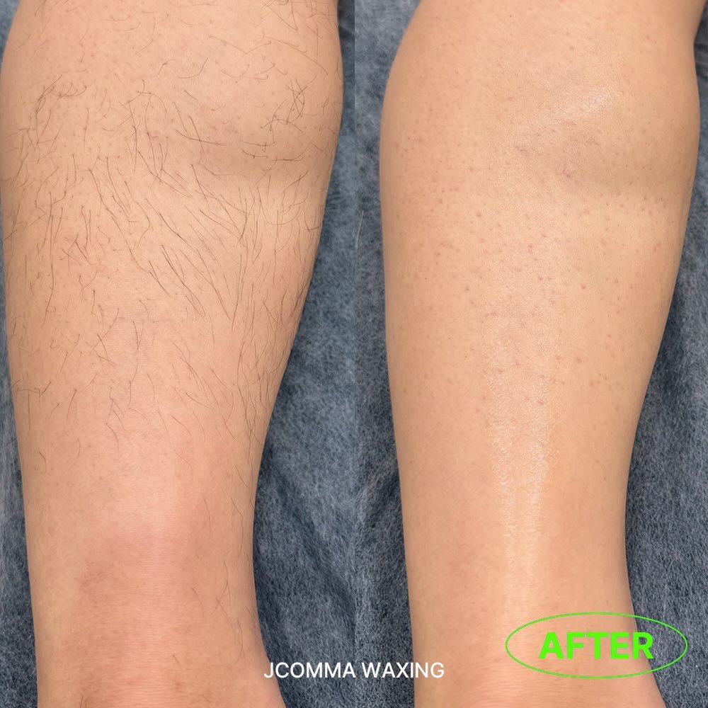 Photo by 제이콤마 대표원장 김주승 🇰🇷 on March 08, 2026. May be an image of text that says 'JCOMMA JCOMMAWAXING WAXING AFTER'.