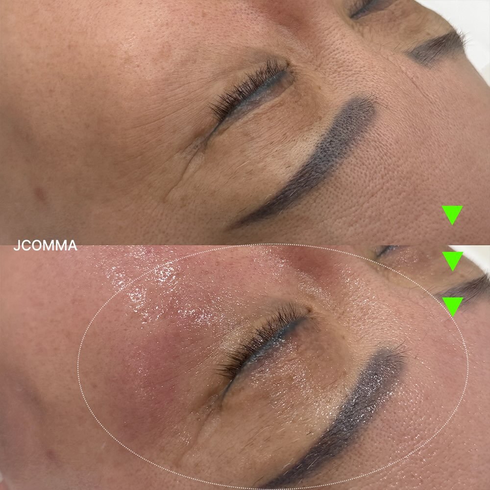 Photo by 제이콤마 대표원장 김주승 🇰🇷 on March 10, 2026. May be an image of text that says 'JCOMMA'.