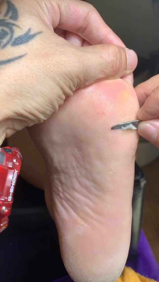 j7210603 게시물 이미지: 腳腳最近是不是有點「粗粗的」🥺
走路卡卡、穿涼鞋不敢近看對不對～

不要害羞啦！
讓我幫你把厚...