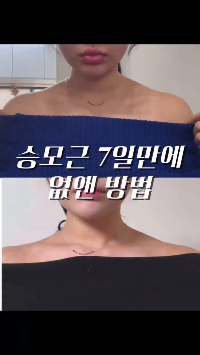 j_ming_dieet 게시물 이미지: 나만 알면 안될거같아서 공유합니다

정보 궁금 하신분들은 “승모근” 달아주시면 바로...