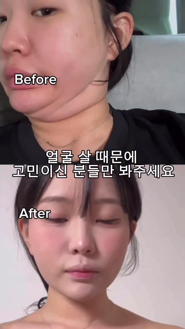 j_ming_dieet 게시물 이미지: 얼굴살 정보 궁금하신다면
댓글에 정보 달아주세요!

#얼굴살 #얼굴살관리...