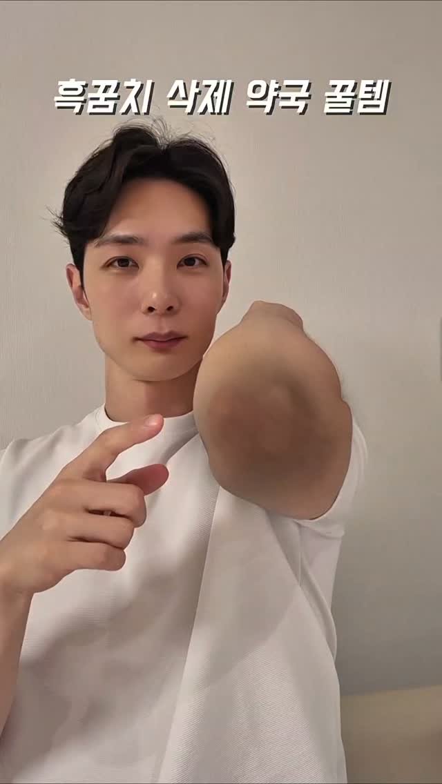 jay_yaksa 게시물 이미지: 거뭇한 팔꿈치, 복숭아뼈 때문에 반바지나 반팔 입기 신경 쓰이셨던 분들 주목!...