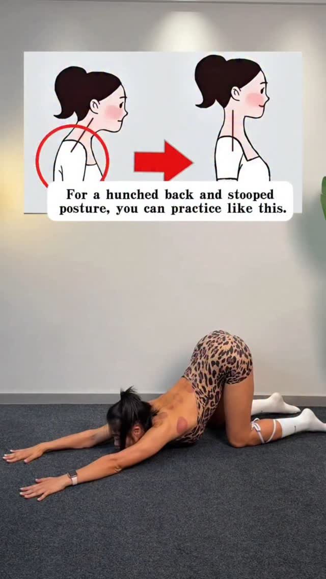 jchuchen123 게시물 이미지: For a hunched back and stooped posture, you...