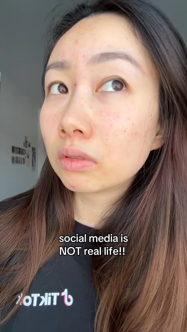 jessmiao_ 게시물 이미지: Almost didn’t film today bc my acne is so bad...