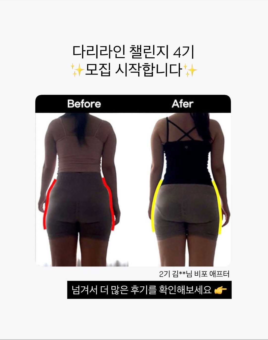 Photo by 지나두잇ㅣ다이어트 • 체형개선 on October 27, 2025. May be an image of text that says '다리라인 챌린지 4기 모집 시작합니다. Before Afer 2기 김**님 비포 애프터 넘겨서 더 많은 후기를 확인해보세요'.